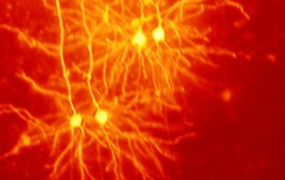 Scientific image of nerves in red and yellow.